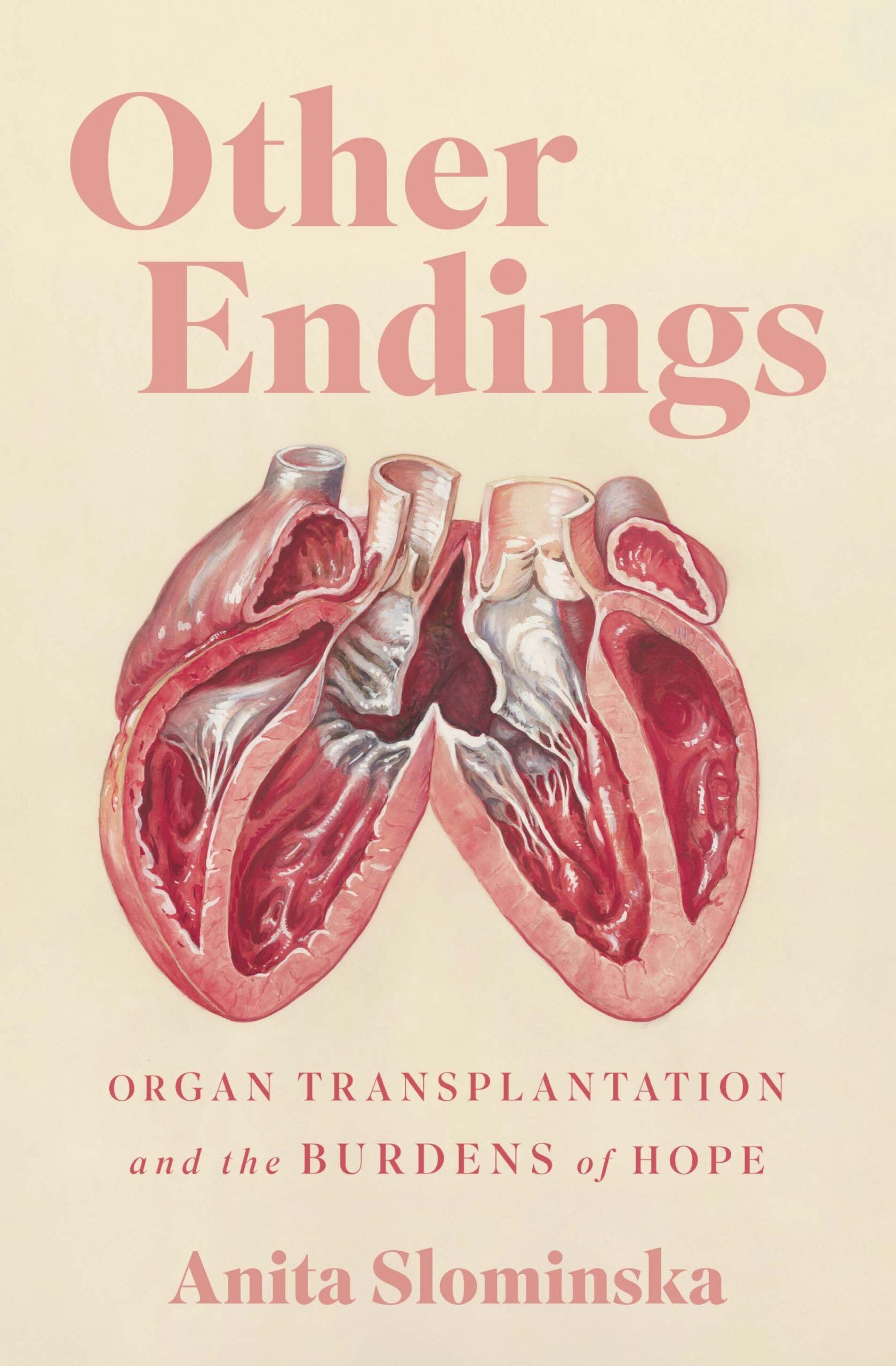 Other Endings: Organ Transplantation and the Burdens of Hope